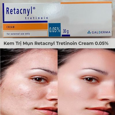 Kem Trị Mụn Retacnyl Tretinoin Cream 0.05% Galderma 30g-4