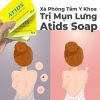 Xà Phòng Tắm Y Khoa Trị Mụn Lưng Atids Soap-1